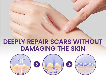 Timilk Regenscar Stem Cell-Inspired Scar Gel