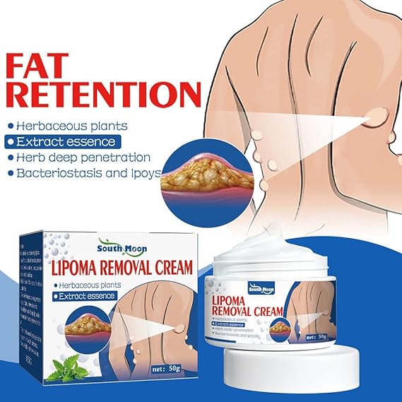 South Moon Herbal Lipoma Relief &amp; Skin-Smoothing Cream