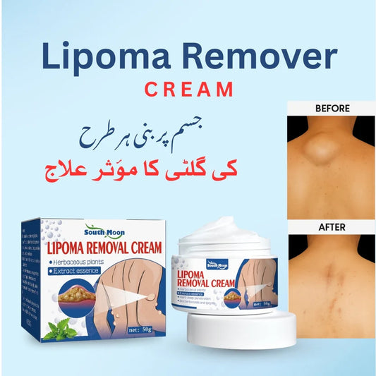 South Moon Herbal Lipoma Relief &amp; Skin-Smoothing Cream