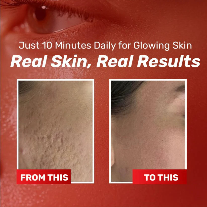 Chalonese Brightening Cream (20g)